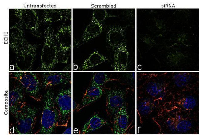 ECH1 Antibody in Immunocytochemistry (ICC/IF)