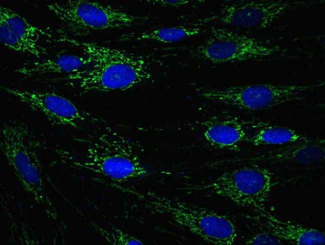 ECH1 Antibody in Immunocytochemistry (ICC/IF)