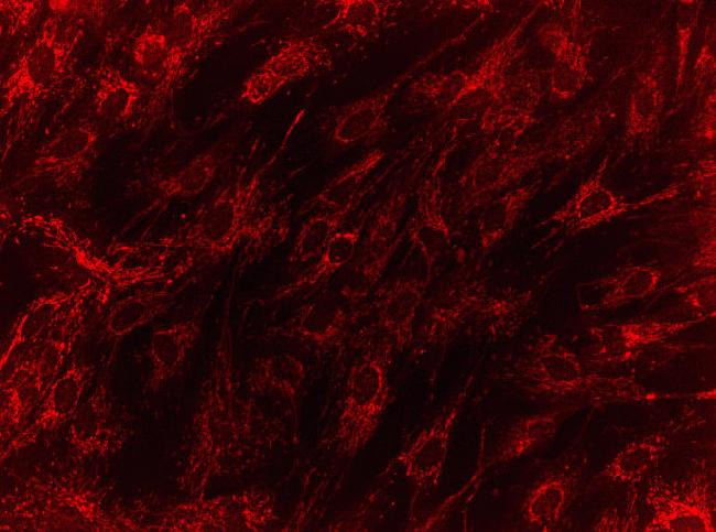 HMGCL Antibody in Immunocytochemistry (ICC/IF)