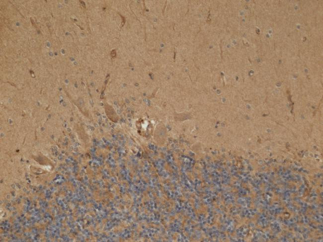 HADH Antibody in Immunohistochemistry (Paraffin) (IHC (P))