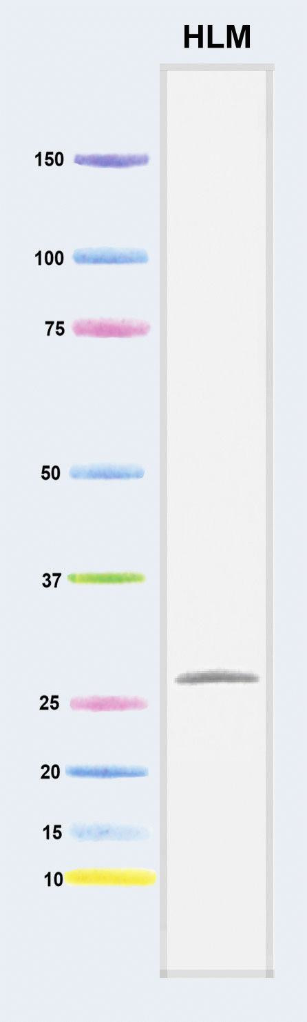 DCXR Antibody in Western Blot (WB)