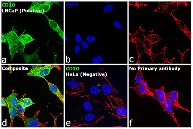 Goat IgG (H+L) Cross-Adsorbed Secondary Antibody in Immunocytochemistry (ICC/IF)