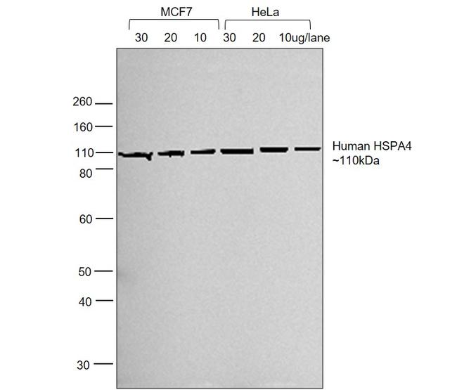 Human IgG (H+L) Cross-Adsorbed Secondary Antibody in Western Blot (WB)