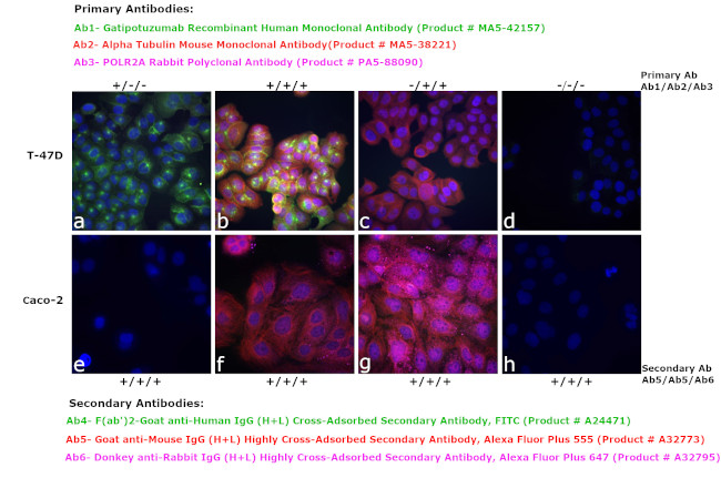 Human IgG (H+L) Cross-Adsorbed Secondary Antibody in Immunocytochemistry (ICC/IF)