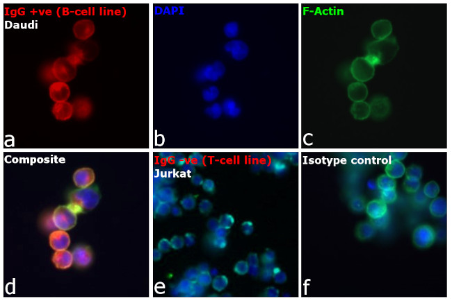 Human IgG, IgM, IgA (H+L) Secondary Antibody in Immunocytochemistry (ICC/IF)