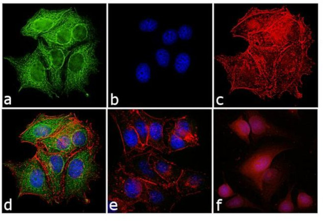 Mouse IgG (H+L) Highly Cross-Adsorbed Secondary Antibody in Immunocytochemistry (ICC/IF)