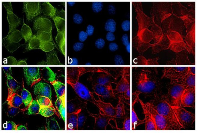 Mouse IgG (H+L) Secondary Antibody in Immunocytochemistry (ICC/IF)