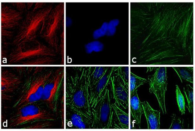 Mouse IgG (H+L) Secondary Antibody in Immunocytochemistry (ICC/IF)