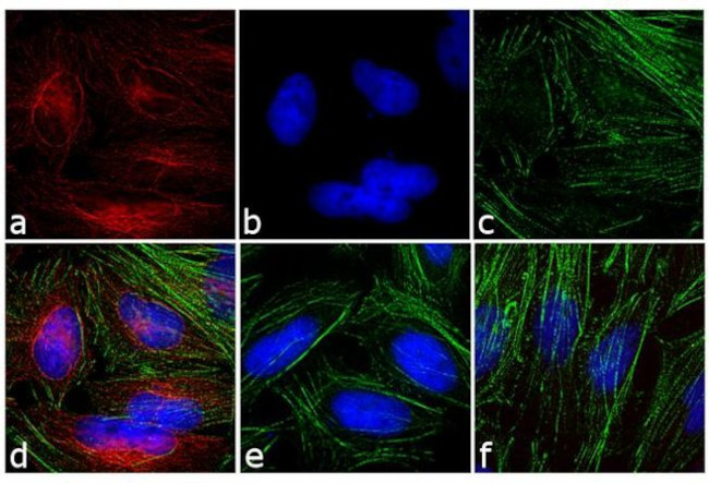 Mouse IgG (H+L) Highly Cross-Adsorbed Secondary Antibody in Immunocytochemistry (ICC/IF)