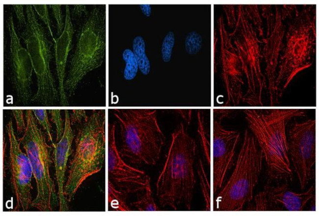 Mouse IgG (H+L) Cross-Adsorbed Secondary Antibody in Immunocytochemistry (ICC/IF)