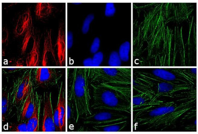 Mouse IgG (H+L) Cross-Adsorbed Secondary Antibody in Immunocytochemistry (ICC/IF)