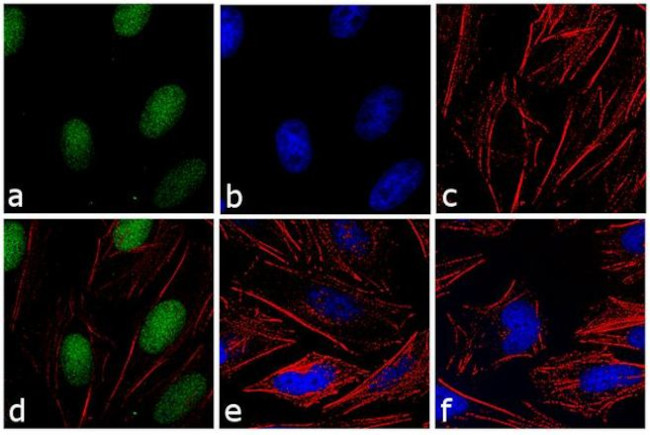 Rabbit IgG (H+L) Secondary Antibody in Immunocytochemistry (ICC/IF)