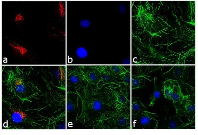 Rabbit IgG (H+L) Cross-Adsorbed Secondary Antibody in Immunocytochemistry (ICC/IF)