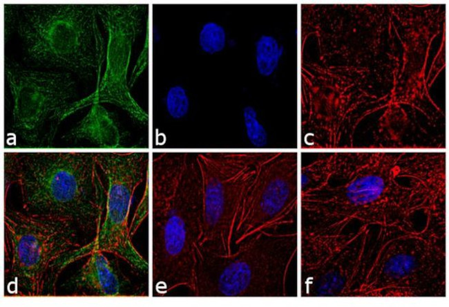 Rat IgG (H+L) Highly Cross-Adsorbed Secondary Antibody in Immunocytochemistry (ICC/IF)