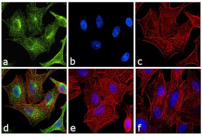 Rat IgG (H+L) Cross-Adsorbed Secondary Antibody in Immunocytochemistry (ICC/IF)