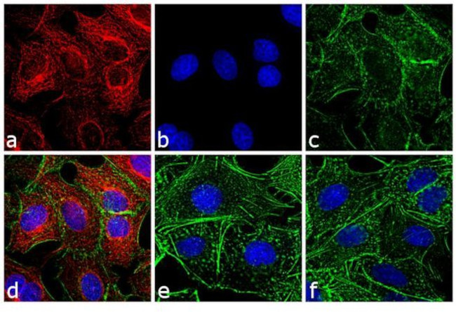 Rat IgG (H+L) Cross-Adsorbed Secondary Antibody in Immunocytochemistry (ICC/IF)