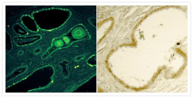 Mouse IgG (H+L) Secondary Antibody in Immunohistochemistry (IHC)