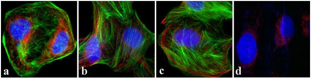 Goat IgG (Heavy Chain) Secondary Antibody in Immunocytochemistry (ICC/IF)