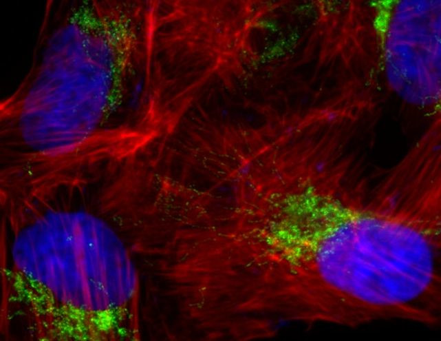 Goat IgG (Heavy Chain) Secondary Antibody in Immunocytochemistry (ICC/IF)