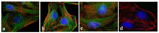 Mouse IgG (H+L) Secondary Antibody in Immunocytochemistry (ICC/IF)