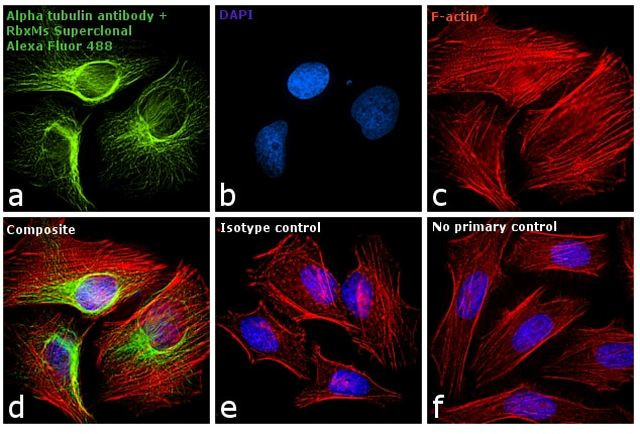 Mouse IgG (H+L) Secondary Antibody in Immunocytochemistry (ICC/IF)