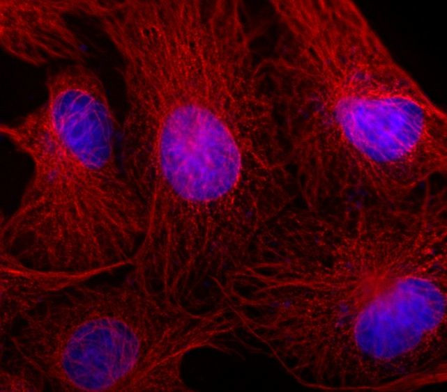 Mouse IgG (H+L) Secondary Antibody in Immunocytochemistry (ICC/IF)