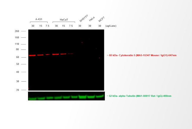 Mouse IgG (H+L) Secondary Antibody in Western Blot (WB)