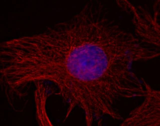 Mouse IgG (H+L) Secondary Antibody in Immunocytochemistry (ICC/IF)