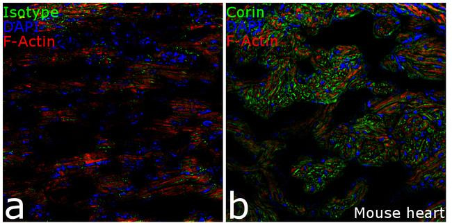 Rabbit IgG (Heavy chain) Secondary Antibody in Immunohistochemistry (Frozen) (IHC (F))