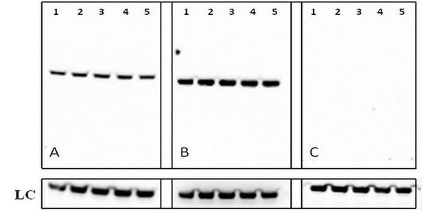 Rabbit IgG (Heavy chain) Secondary Antibody in Western Blot (WB)