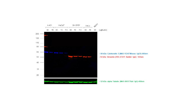 Rabbit IgG (Heavy chain) Secondary Antibody in Western Blot (WB)