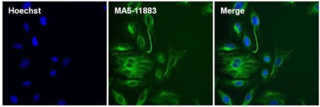 Mouse IgG (H+L) Secondary Antibody in Immunocytochemistry (ICC/IF)