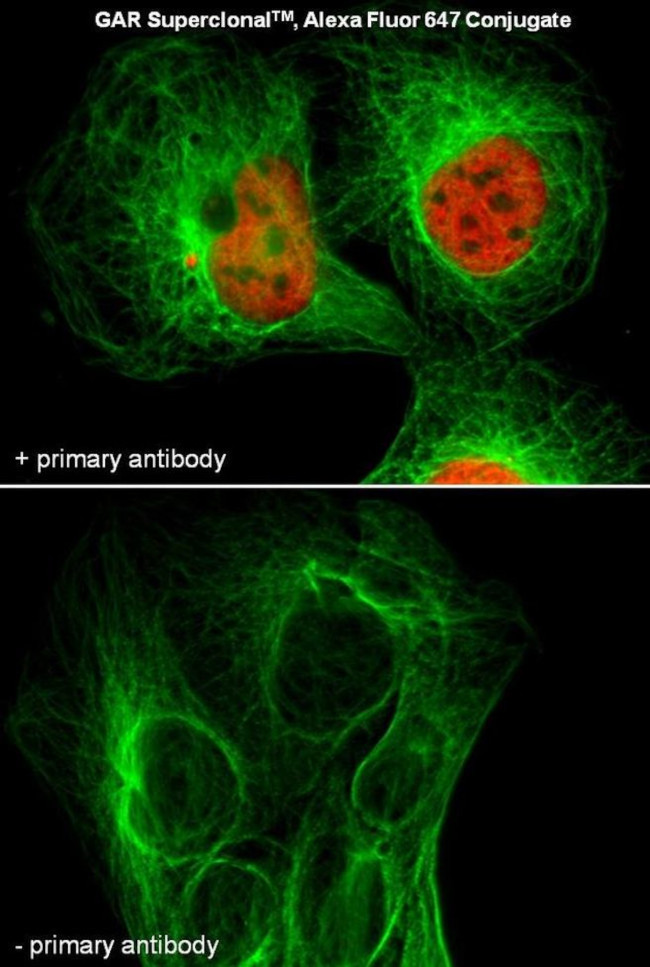 Mouse IgG (H+L) Secondary Antibody in Immunocytochemistry (ICC/IF)