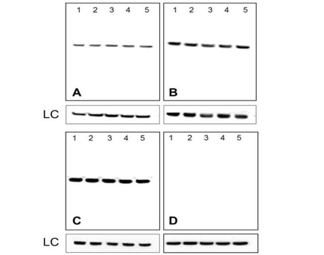 Mouse IgG (H+L) Secondary Antibody in Western Blot (WB)