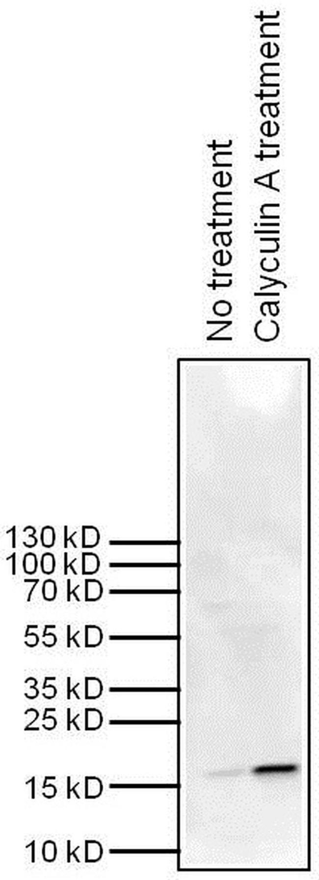 Mouse IgG (H+L) Secondary Antibody in Western Blot (WB)