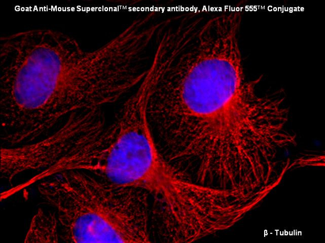 Mouse IgG (H+L) Secondary Antibody in Immunocytochemistry (ICC/IF)