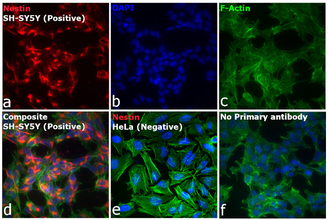 Mouse IgG (H+L) Secondary Antibody in Immunocytochemistry (ICC/IF)