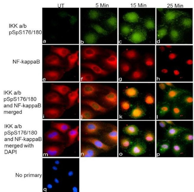 Mouse IgG (H+L) Secondary Antibody in Immunocytochemistry (ICC/IF)