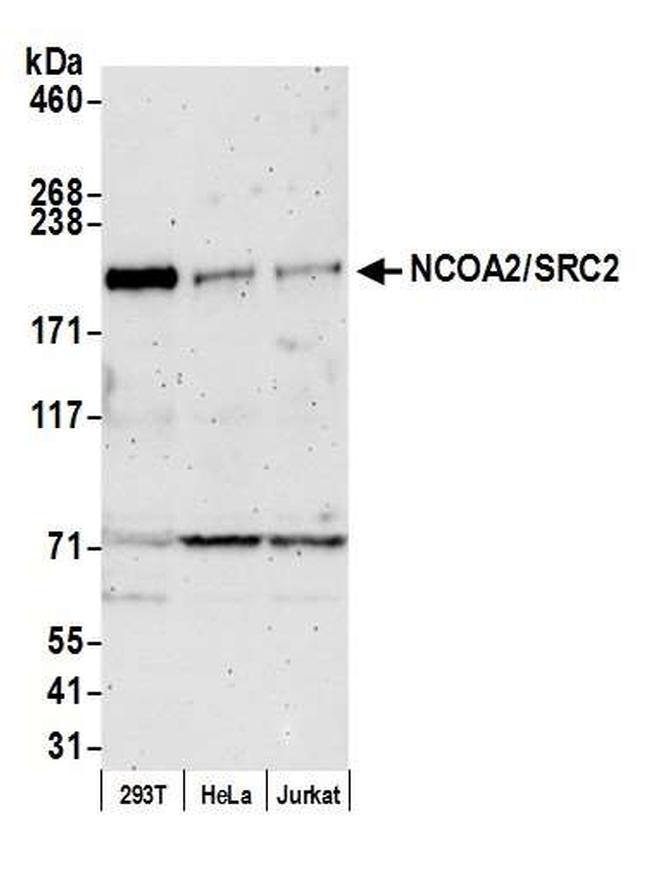 NCOA2/SRC2 Antibody in Western Blot (WB)