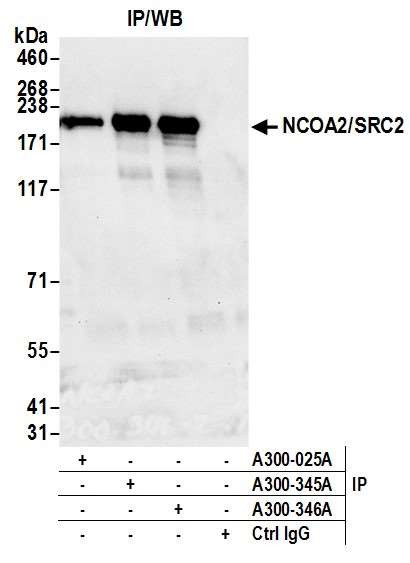 NCOA2/SRC2 Antibody in Immunoprecipitation (IP)