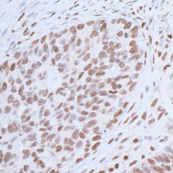 USP7 Antibody in Immunohistochemistry (Paraffin) (IHC (P))