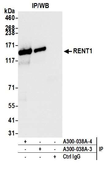 RENT1 Antibody in Immunoprecipitation (IP)