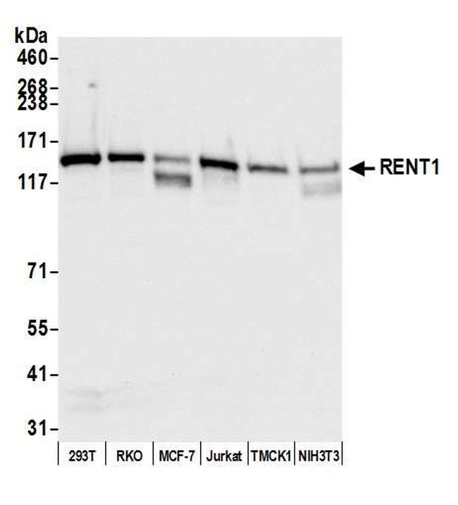 RENT1 Antibody in Western Blot (WB)