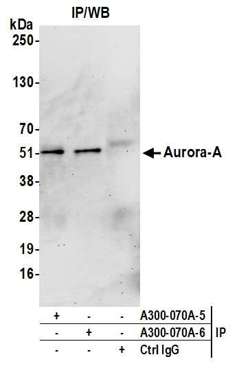 Aurora A Antibody in Immunoprecipitation (IP)