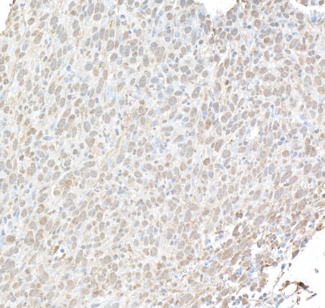 Phospho-gamma-H2AX (Ser139) Antibody in Immunohistochemistry (Paraffin) (IHC (P))