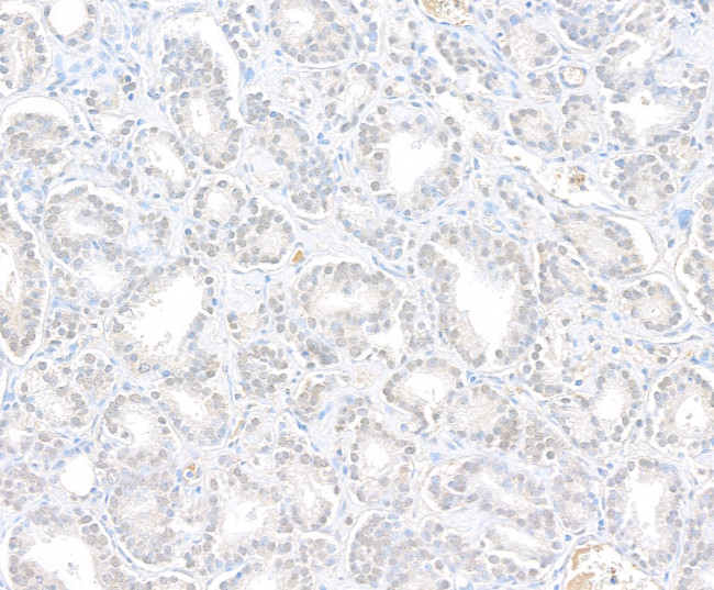 Menin Antibody in Immunohistochemistry (Paraffin) (IHC (P))