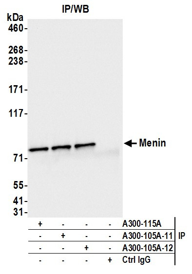 Menin Antibody in Immunoprecipitation (IP)