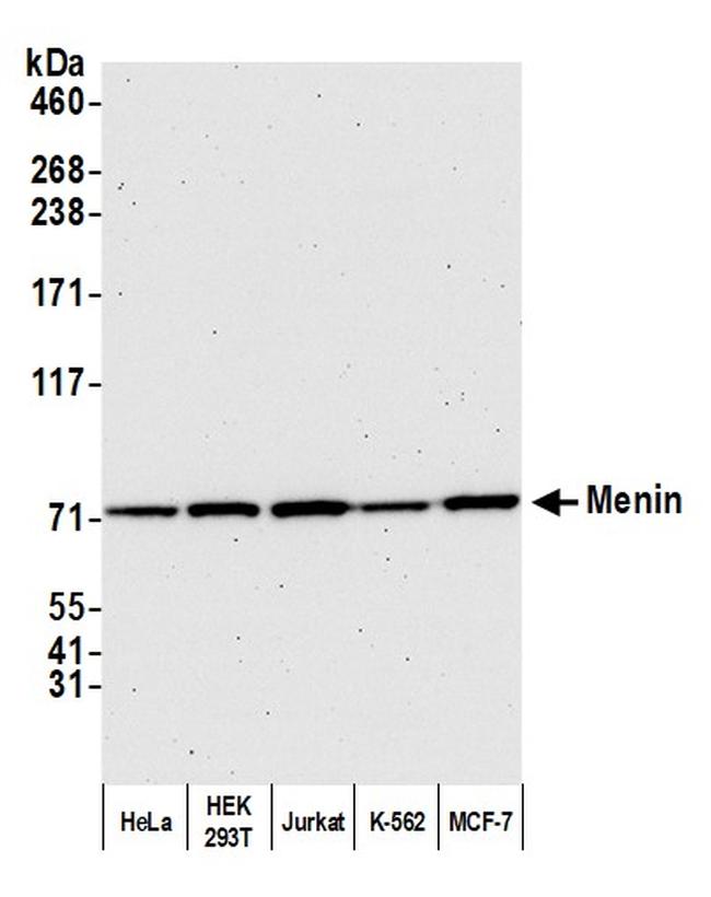 Menin Antibody in Western Blot (WB)