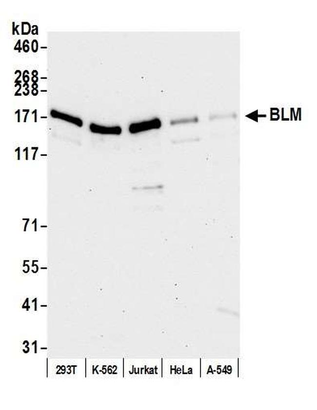 BLM Antibody in Western Blot (WB)