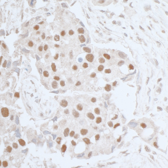 Leo1 Antibody in Immunohistochemistry (Paraffin) (IHC (P))